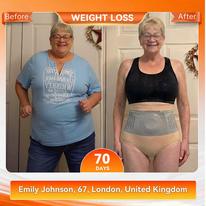 Official Brand Store | 𝓵𝓾𝓬𝓴𝔂𝓼𝓸𝓷𝓰® 2026 4-in-1 Shaping and Fat-Burning Shorts with Moringa and Berberine