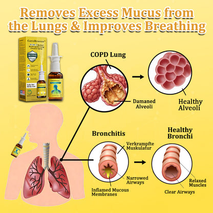 ⚡🐝✅UK Official Store:CareBreeze® 6-in-1 Herbal BeePropolis Lung Cleanse Spray（👨‍⚕️Directly acts on COPD, asthma, chronic bronchitis (CB), respiratory infections, lung cancer, sinusitis, and other conditions）