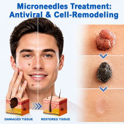 Finally A Simple Way To Address Common Skin Imperfections At Home