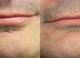 Finally A Simple Way To Address Common Skin Imperfections At Home