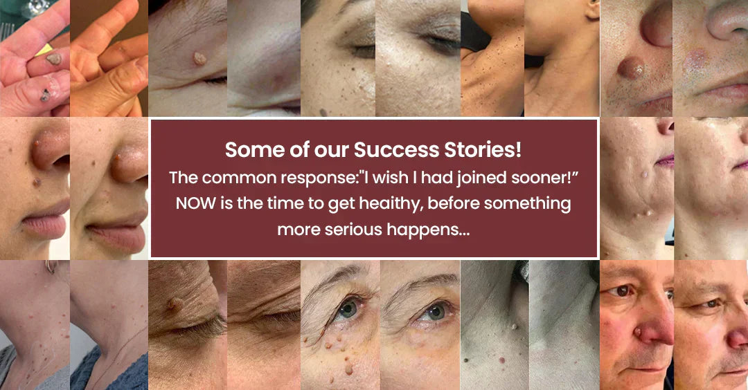 Finally A Simple Way To Address Common Skin Imperfections At Home