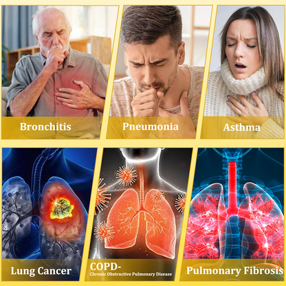 ⚡🐝✅UK Official Store:CareBreeze® 6-in-1 Herbal BeePropolis Lung Cleanse Spray（👨‍⚕️Directly acts on COPD, asthma, chronic bronchitis (CB), respiratory infections, lung cancer, sinusitis, and other conditions）