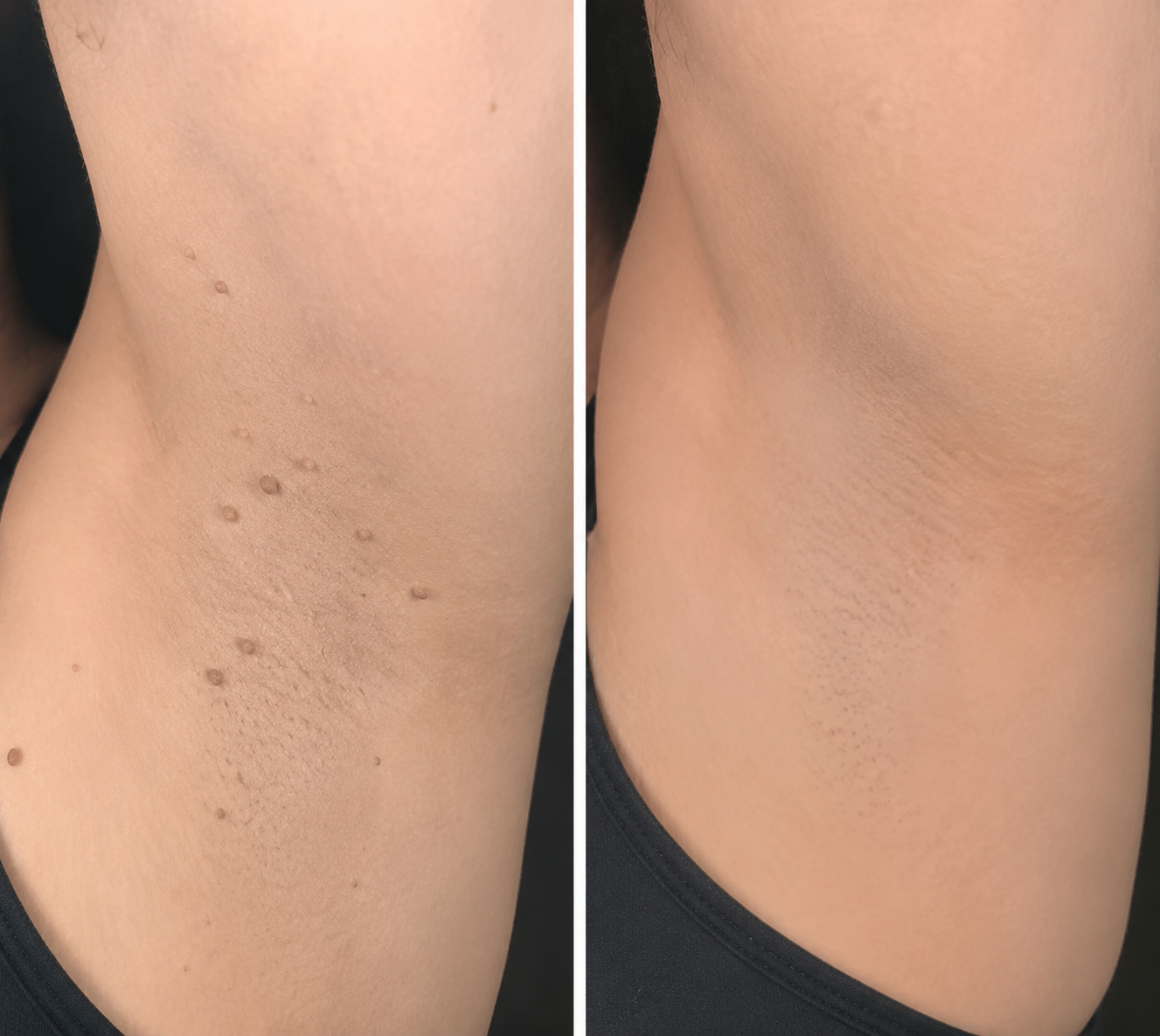 Finally A Simple Way To Address Common Skin Imperfections At Home