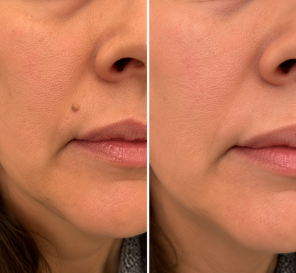 Finally A Simple Way To Address Common Skin Imperfections At Home
