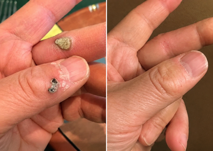Finally A Simple Way To Address Common Skin Imperfections At Home